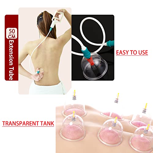 MYMM 12 Cupping Cups Sets Biomagnetic Traditional Professional Chinese Therapy Massage - AB Mystery