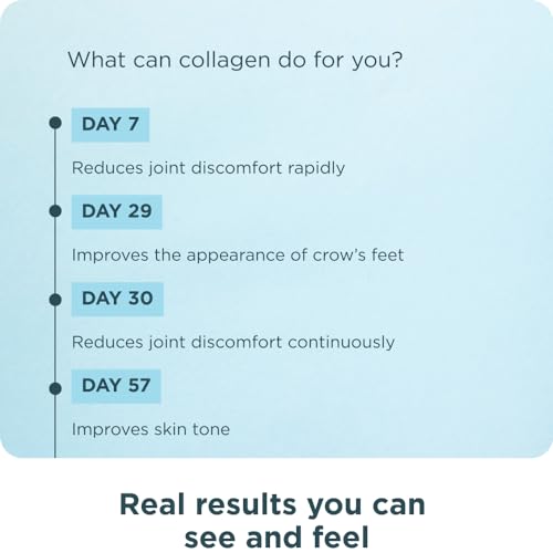 Collagen Powder Protein by Ancient Nutrition, Multi Collagen Vanilla Protein Powder - AB Mystery