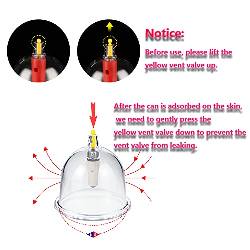 MYMM 12 Cupping Cups Sets Biomagnetic Traditional Professional Chinese Therapy Massage - AB Mystery