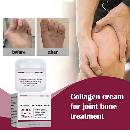 Joint Collagen Relieves Joint Soreness And Body Joint Care Collagen Get Thick Products - AB Mystery