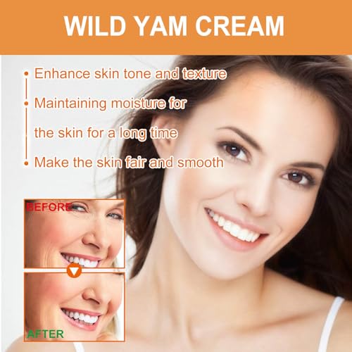 Mzluyin Wild Yam Cream,Annas Wild Yam Cream Organic Wild Yam Root Cream - AB Mystery
