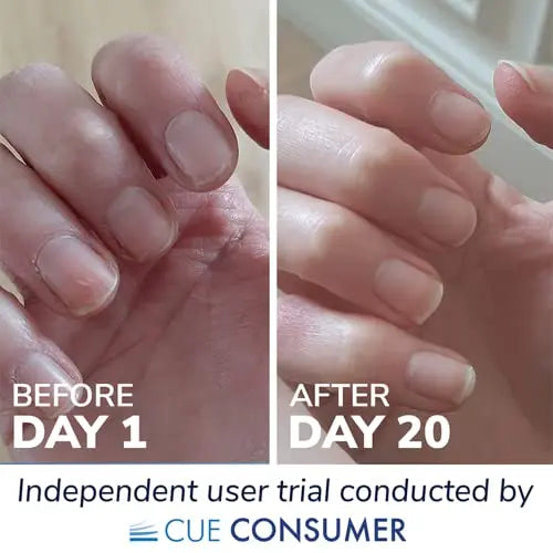 Reverse Life Marine Collagen Liquid Supplement Drink - High-Strength 10,000mg Hydrolysed Peptide Infused Reverse Life