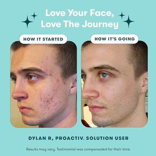 Proactiv 3 Step Acne Treatment - Benzoyl Peroxide Face Wash, Repairing Acne Spot - AB Mystery