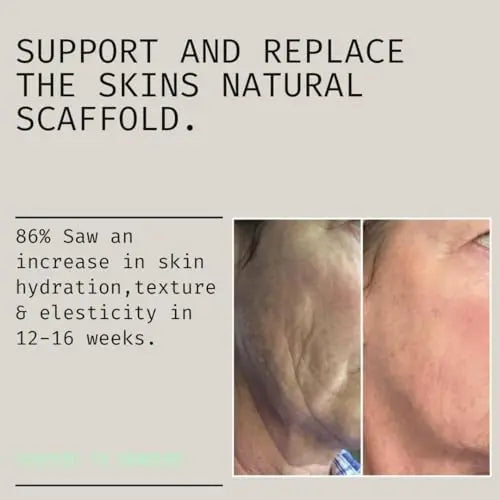 Marine Collagen Liquid 9000mg High Strength Supplement +Biotin, Vitamin B, C, E, Zinc & Turmeric & Ginger SKNZERO