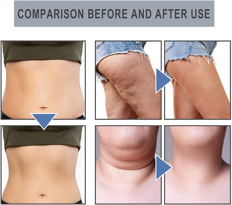 14Pcs Superslim S_limming & Detoxifying Essential Oil Ring, Firming Essential Oil Ring - AB Mystery