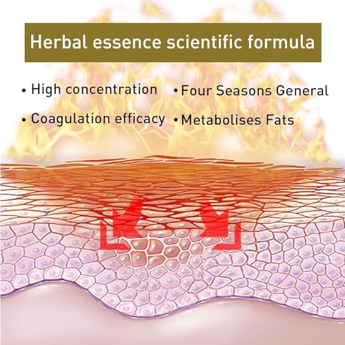 Tarcegta Bee Venom Lymphatic Drainage and Slimming Nose Ring, Bee Venom Lymphatic Drainage - AB Mystery