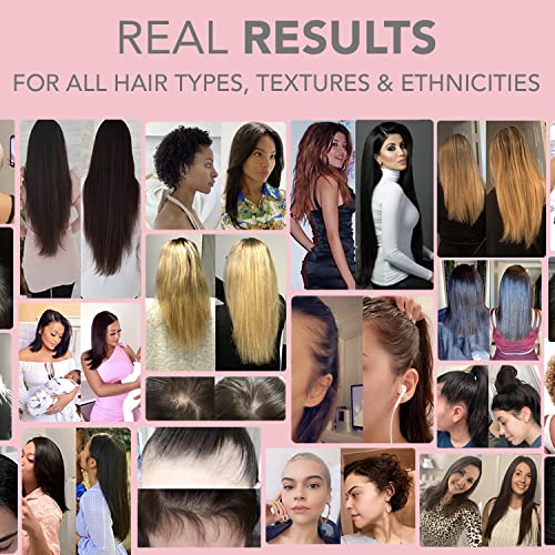 HAIRtamin MOM Vegan Prenatal & Postnatal Multivitamin Supplement & Hair Vitamin Pregnancy HAIRtamin