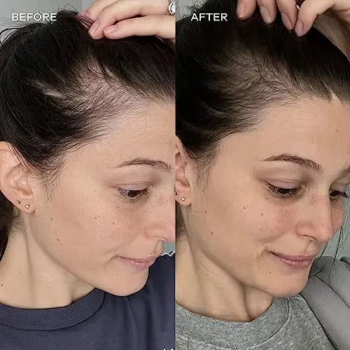 Vida Glow - Natural Hydrolysed Marine Collagen Sachets | Promotes Glowing Skin + Smooths Fine Lines - AB Mystery