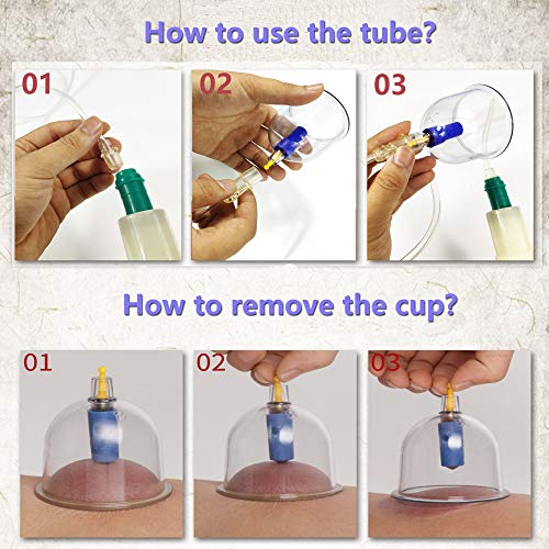 MYMM 12 Cupping Cups Sets Biomagnetic Traditional Professional Chinese Therapy Massage - AB Mystery