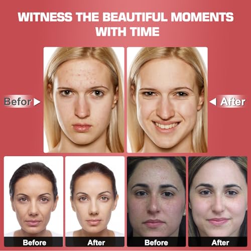 Red Light Therapy M-Ask Red Light Facial M-Ask Red Light Therapy for Face 7-1 Colors Light for Face Home Use - AB Mystery