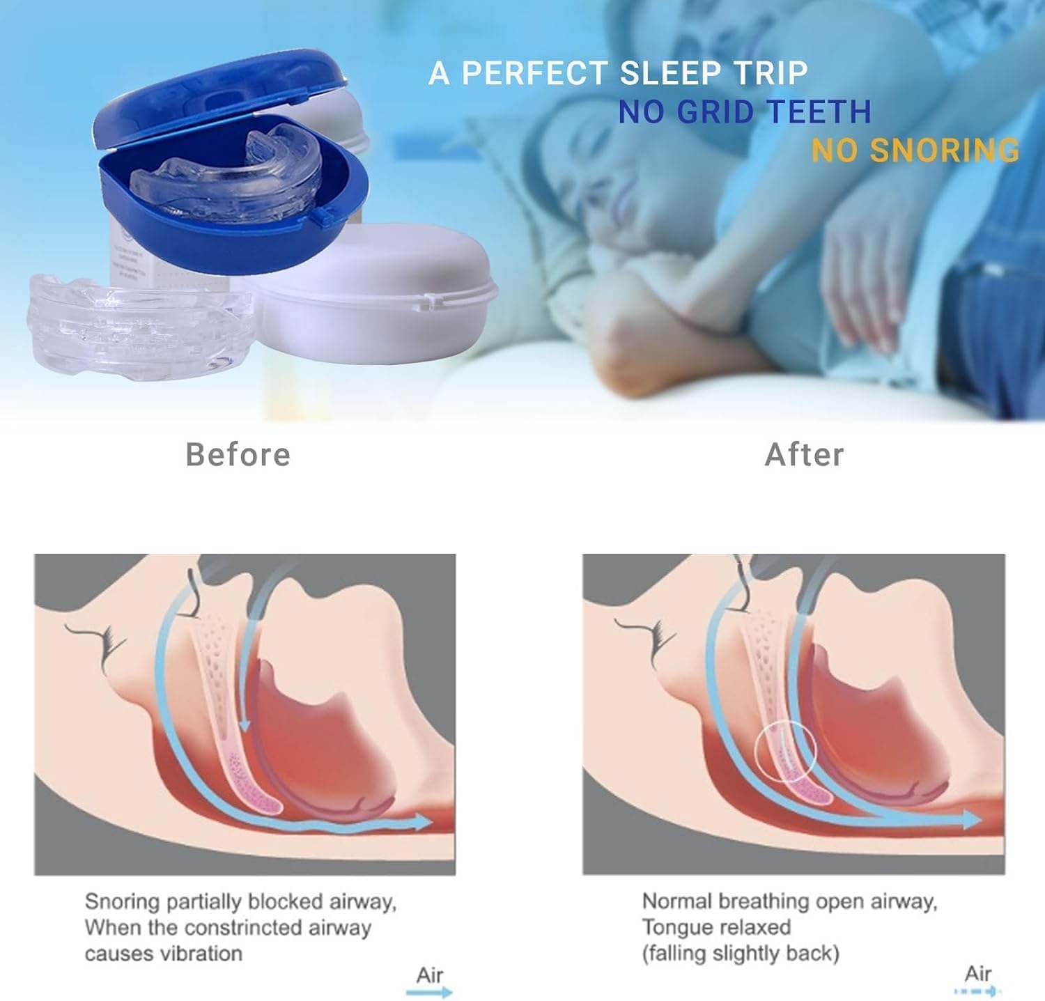 SereneSleep Mouthpiece (Blue) - AB Mystery