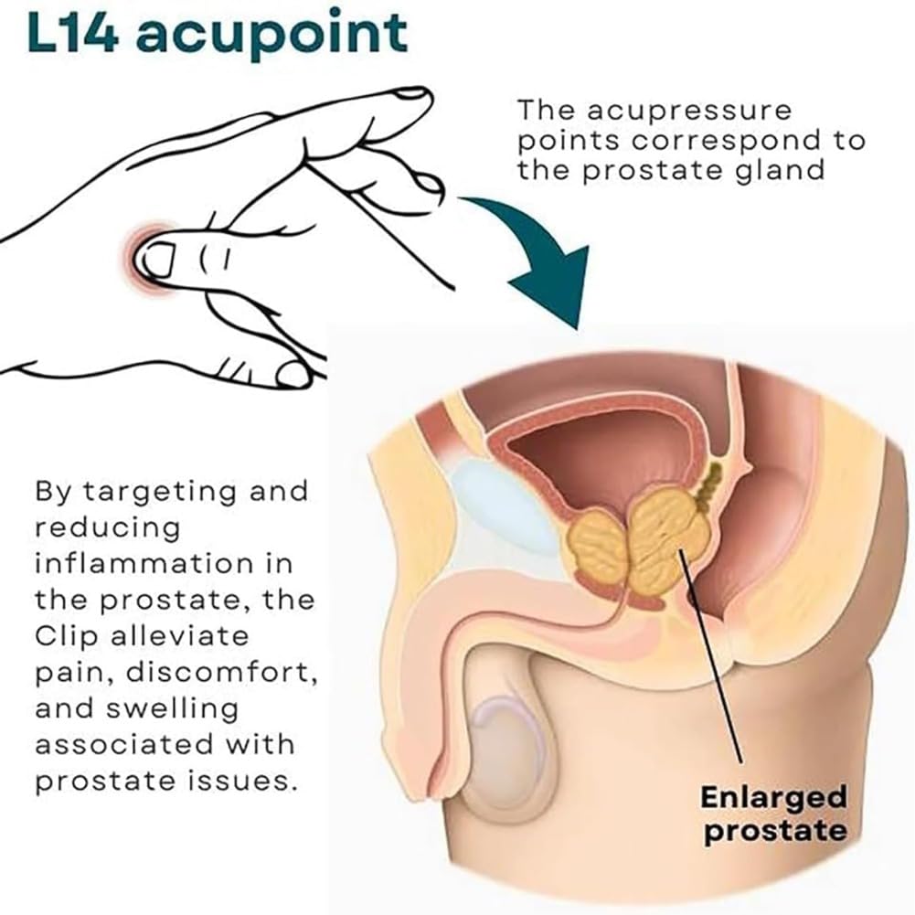 2pcs Prostate Care Point Clip for Men,Acupressure Hand Pressure Point Clip, Relieve Prostate - AB Mystery