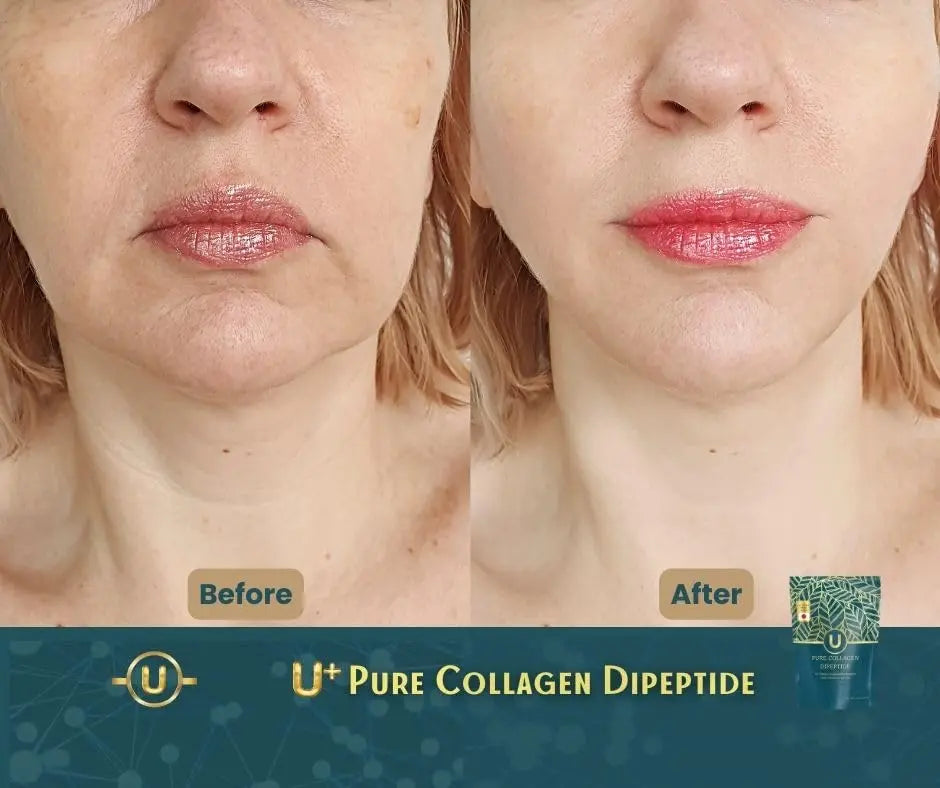U+ Pure Collagen Dipeptide Supplement - Advanced Hydrolyzed Collagen Powder for Skin, Hair U+ Pure Collagen