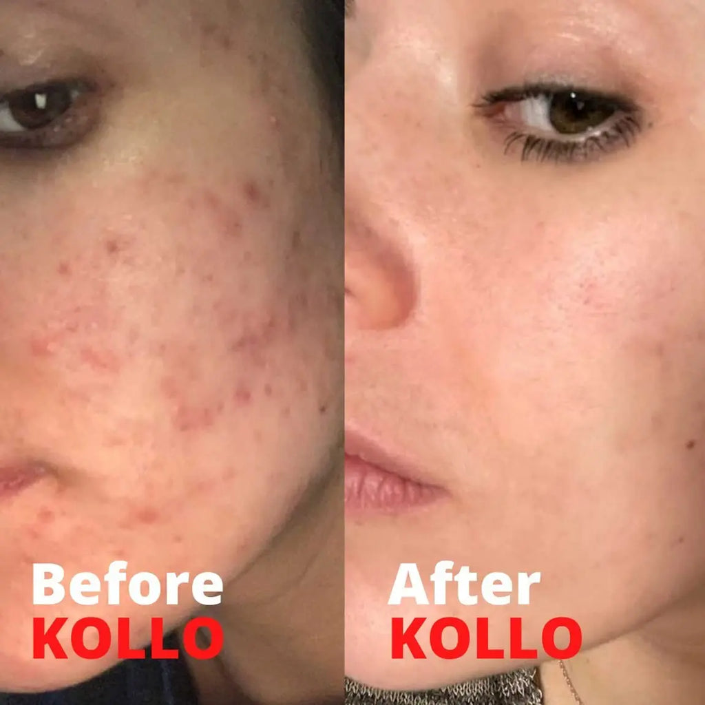 Kollo Premium Marine Collagen Liquid, 10,000 mg - Essential Proteins Collagen Peptides Kollo