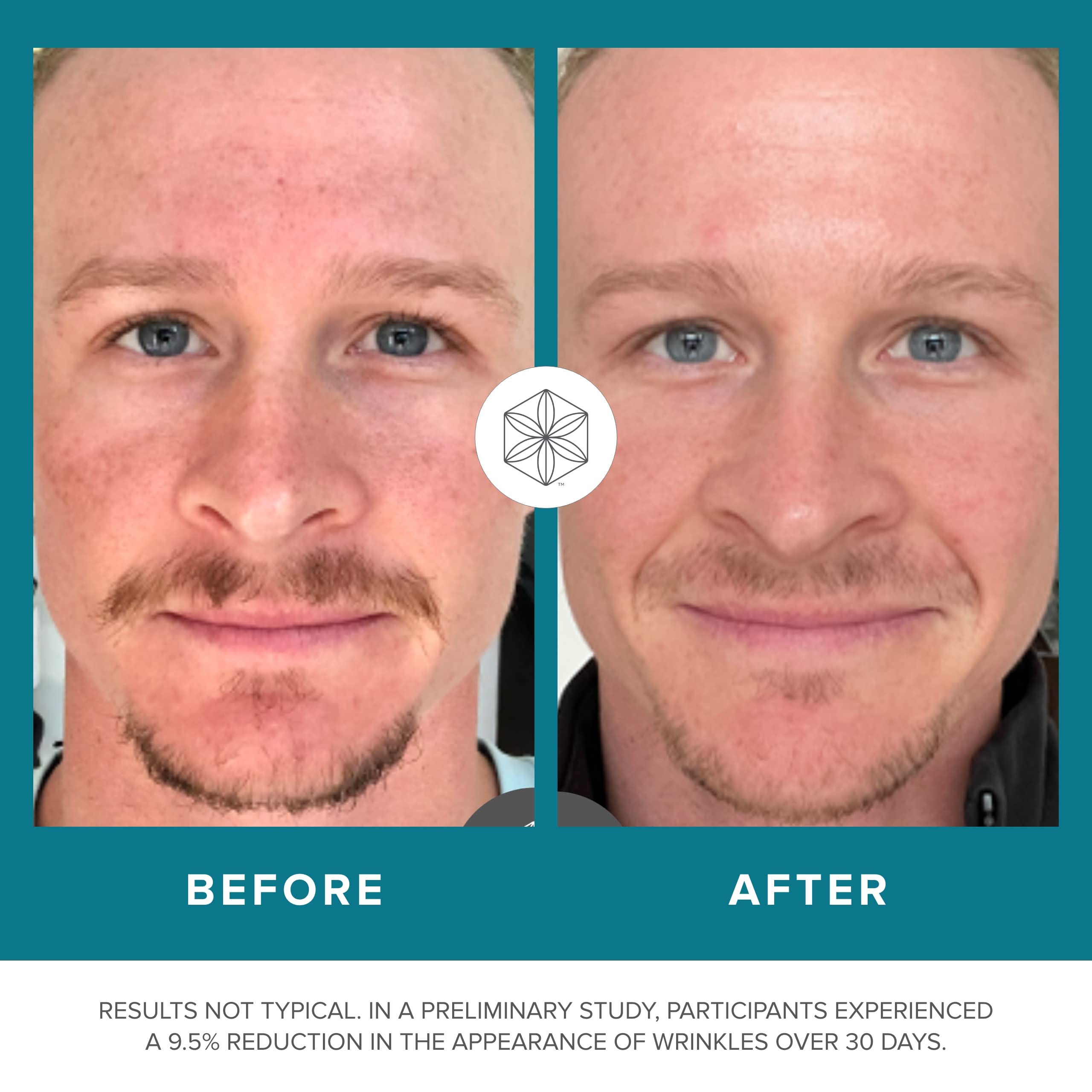 Isagenix Collagen Elixir - Collagen Drink with Marine Collagen Peptides - Liquid Collagen - AB Mystery