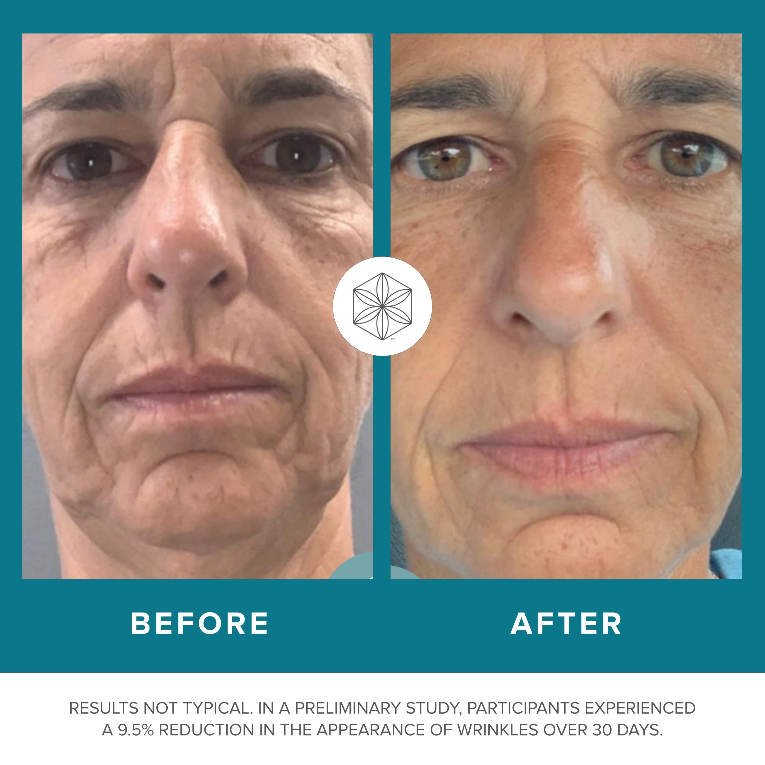 Isagenix Collagen Elixir - Collagen Drink with Marine Collagen Peptides - Liquid Collagen - AB Mystery