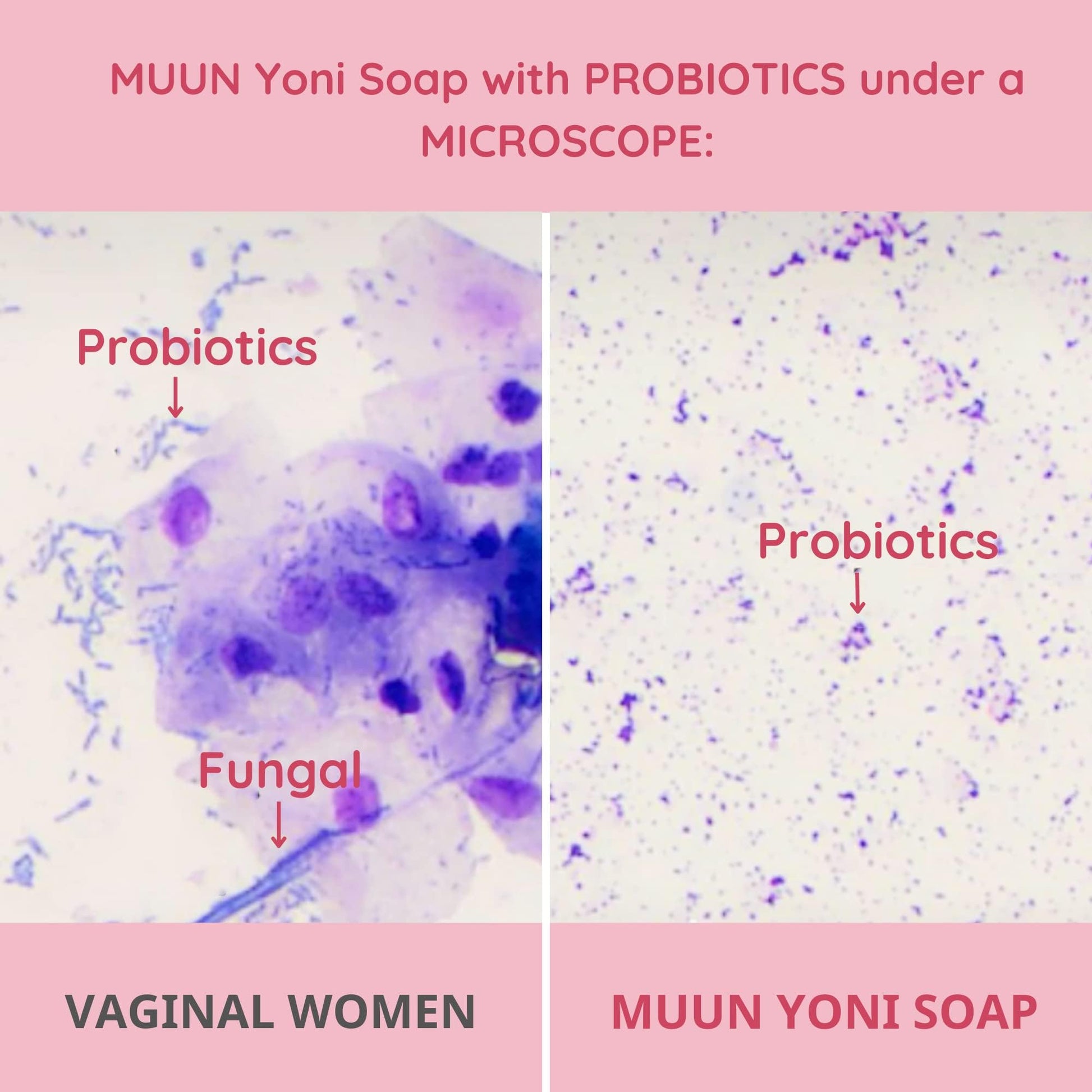 Muun Yoni Soap Bar - Pack 3 Ph Balance Probiotics & Natural Ingredients - Gentle Cleansing Formula - AB Mystery