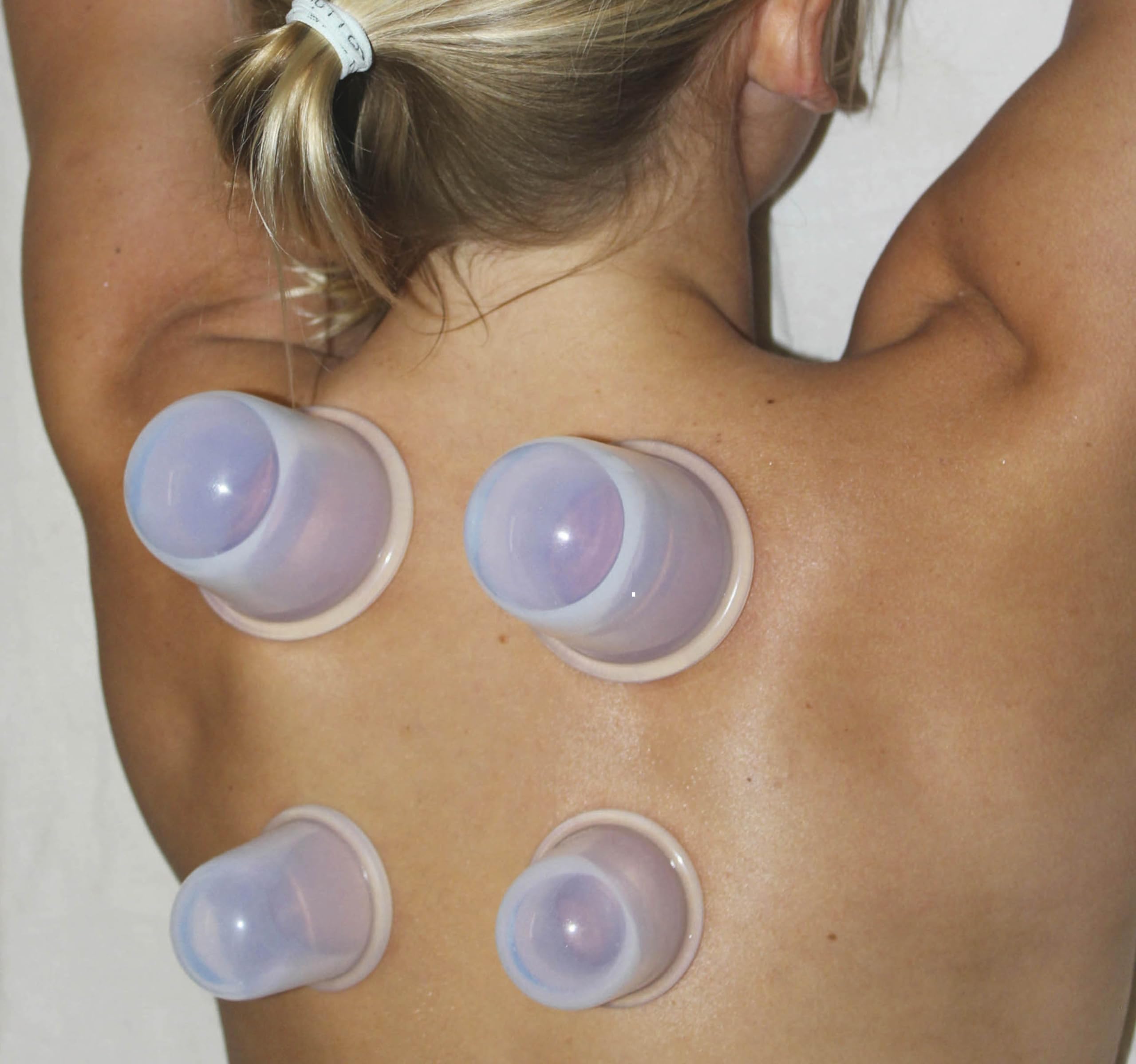 Cupping Kit for Massage Therapy - by DoSensePro, Cupping Set of 6 Professional Silicone Cups - AB Mystery